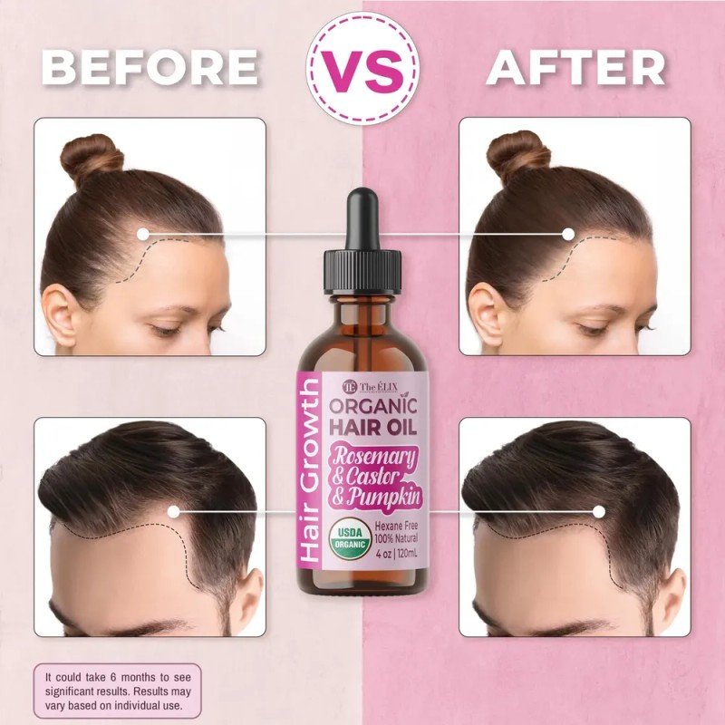 Aceite Capilar The Elix Organic Hair Growth 120 Ml Con