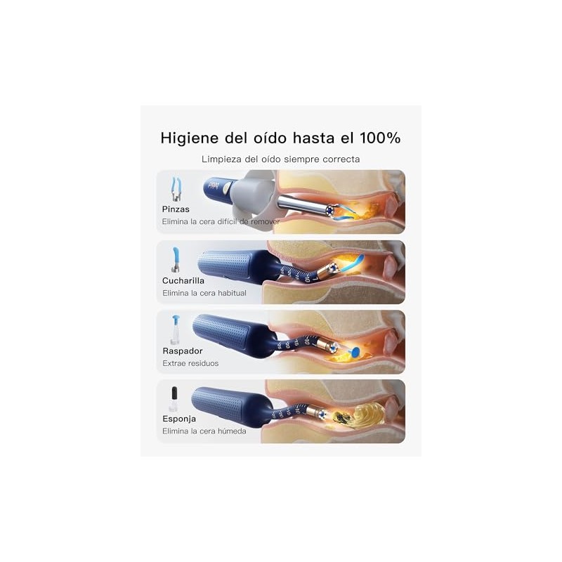 Bebird Limpiador de Oídos con Otoscopio Digital HD, Cámara Flexible,