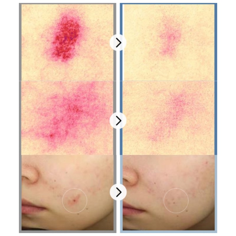 HEVE BLUE Phyton Squa Hyal Blue Tone Up Sun Cushion