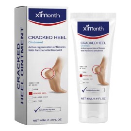 ! Crema De Urea Para Protección De Manos Y Pies En V Que .