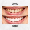 Puur Smile Teeth Whitening Pen - Best Teeth whitening Gel