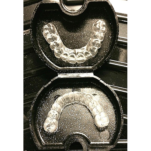 Custom Dental Retainer Custom Fit Set Orthodontic Dental Retainers~Upper AND