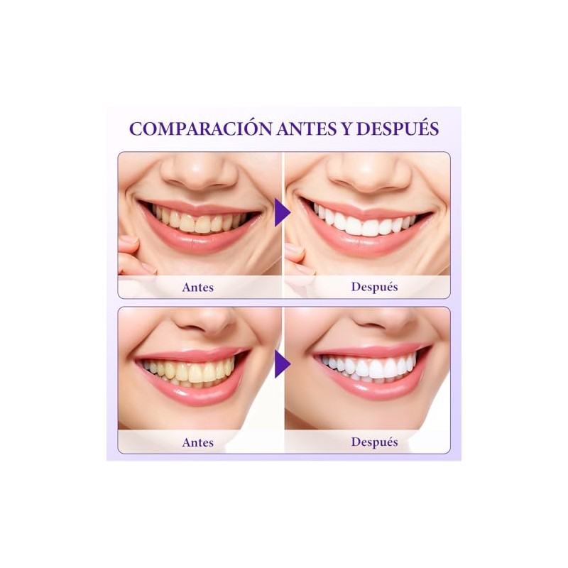 Tiras Blanqueadoras de Dientes, Whitening Strips, Bandas Dentales Blanqueadoras, Blanqueador