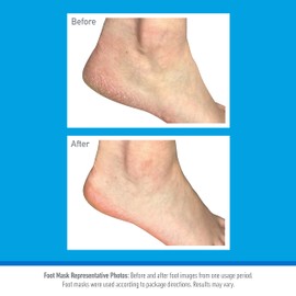 O’Keeffe’s Healthy Feet Foot Mask – Intensive Moisturising Sock Treatment for Extremely Dry, Rough Feet & Cracked Heels – Visible Results in One Use (2 Pairs)