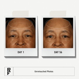 Rodan + Fields Redefine Pore Minimizing Toner | 4.2 fl oz | Deep Exfoliating Cleanser | Visibly Reduces Blackheads | Formulated with Fruit Acids