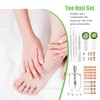 134Pcs Eingewachsene Zehennägel Set Nagelspange Fußnägel Zehennagel Korrektur Zehennagel Eingewachsen