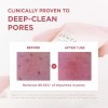 Skin1004 스킨1004 포머라이징 딥 클렌징 폼 4.23 fl.oz 125ml 메이크업