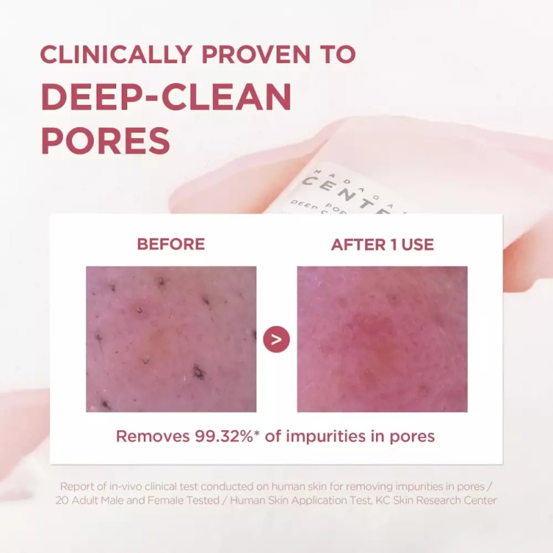 Skin1004 스킨1004 포머라이징 딥 클렌징 폼 4.23 fl.oz 125ml 메이크업