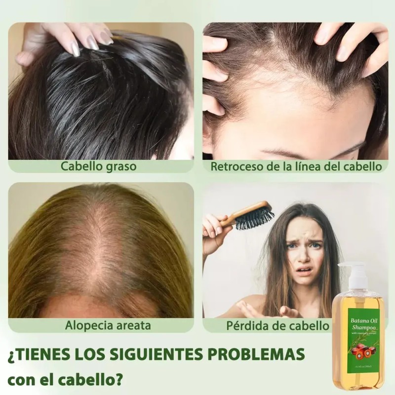 Shampoo 2 en 1 Oxyglow Batana y Romero para Crecimiento