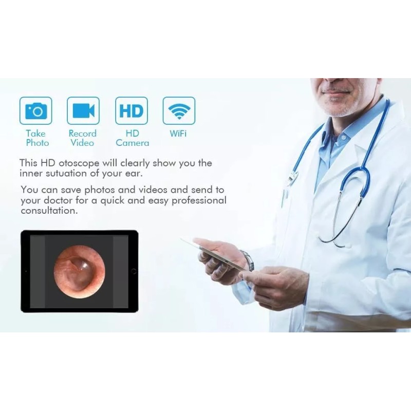 Teslong Otoscopio Digital Recargable Con Wifi Integrado. Ios Android