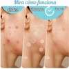 GeeRic Parches para Acné Invisibles, 180 Unidades, Hidrocoloide