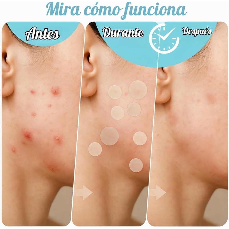 GeeRic Parches para Acné Invisibles, 180 Unidades, Hidrocoloide