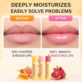3PCS Bees Lips Balm Honey Lip Balm Set,Mini Lip Balms for Dry Cracked Lips,Moisturising Lip Care Set with Vitamin E,Hydrating Tinted Lip Care,3 Fruity Flavours Natural Formula,Reduce Lip Lines