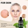 Fiora Naturals Fiora Naturals Tea Tree Oil & Peppermint Oil
