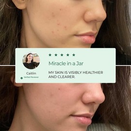 PLANTIFIQUE Superfood Marine Clay Mask - Korean Face Mask - Dermatologist Tested for Face and Body - Vegan Skincare - Face Mask with Avocado