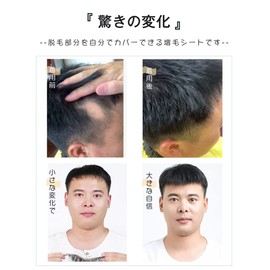 HIYE Partial Wig Hair Enhancement Sheet 100% Human Hair Circular Hair Loss M Shape Hidden Natural Hair Growth Seal Type Hair Area Hair Wigs Hairline Light Men Men Hair Loss Thin Hair Piece Diffuse