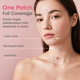 BAGLAK BAGLAK Pimple Patches for Face, 320 Counts 5 Sizes Large Patches, Hydrocolloid Blemishes Patch, Spot Dots Cover for Body, Chin, Cheek Zits & Blemish & Breakouts
