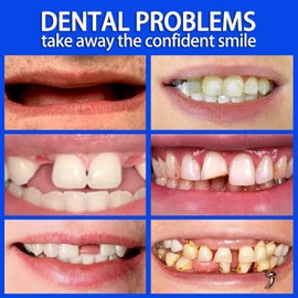 Clip in Veneers Teeth, 1 Pair of Soft Denture Reline Kit, Soft Dentures for Adults, False Teeth Set for Men and Women, Upper and Lower,Denture Repair Kit