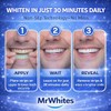 Teeth Whitening Strips Professional Strength – 21 Treatments (42 Strips)