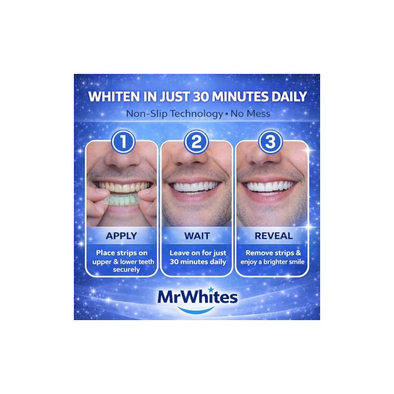Teeth Whitening Strips Professional Strength – 21 Treatments (42 Strips)