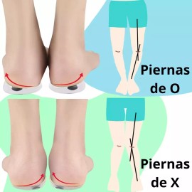 Veraly Plantillas Ortopédica Pronador Pierna Arqueada Silicon Pie F Color Transparente Tamaño De La Plantilla Unitalla