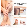 VICASKY Professional Foot Care Tool Callus Remover Foot File Easy