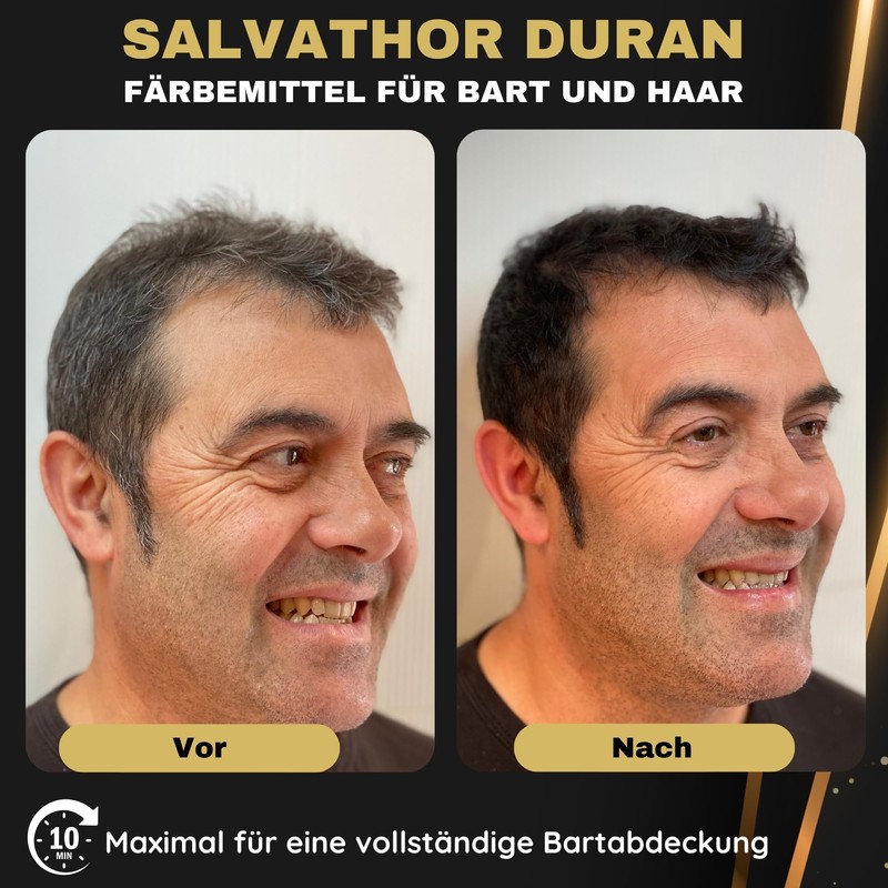 Beard Dyeing Men - Beard Colour Black - Beard Dye