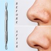 The Body Tools ® Professional Blackheads Whiteheads Remover Extractor Facial