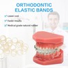Xumann 400 PCS Orthodontic Elastic Bands, Braces Band for Dentist
