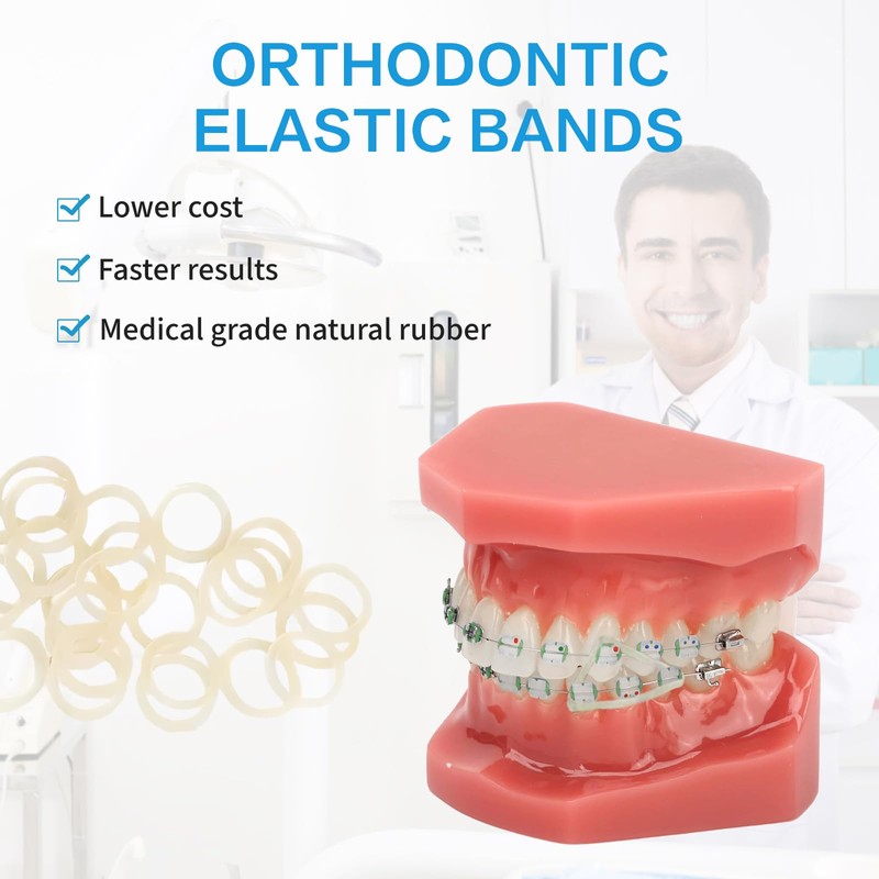 Xumann 400 PCS Orthodontic Elastic Bands, Braces Band for Dentist