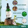 ABERA Alan Silver Nano Serum - Treat psoriasis, ringworm, restore