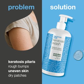 Keratosis Pilaris Body Wash – Targets Bumpy Skin, Strawberry Legs & Chicken Skin – with Salicylic Acid & Niacinamide
