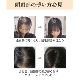 HIYE 部分ウィッグ 100%人毛 トップカバー 総手植え 肌色ネット 人工皮膚付け 抜け毛 増量用ヘアピース つむじカバー ストレート レディース ハゲ隠し ミセス ウィッグ 3D 軽薄 人毛ウイッグ ノーカット (12*13(35CM), 栗色)