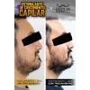 Tónico De Crecimiento Para Barba Y Cabello - Pack 6