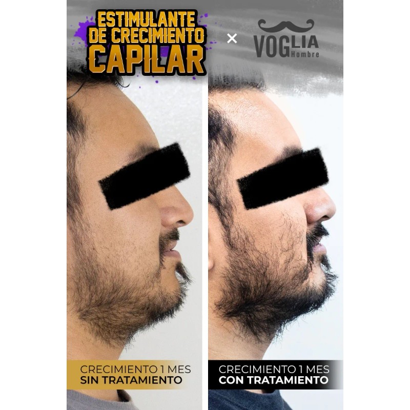Tónico De Crecimiento Para Barba Y Cabello - Pack 6
