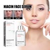 Xiulilydai Niacin Facial Essence Hydrating Moisturizing Acne Marks Pore Shrinking