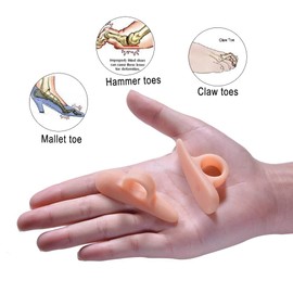 PEDIMEND™ Hammerzehen-Glätteisen aus Silikongel – Zehenspreizer für überlappende Zehen – dehnt und richtet die Zehen aus – perfekt für Hammerzehen/schiefe Zehen/Krallenzehen – Unisex – Fußpflege