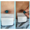 10PC Soft Silicone Belly Button Plug for Tummy Tuck Recovery