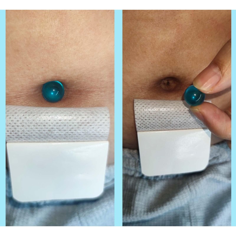 10PC Soft Silicone Belly Button Plug for Tummy Tuck Recovery