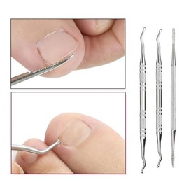 큐렛 3종세트 손톱 발톱 정리기 네일 Curette 3-Piece Set Nail and Toenail Trimmer