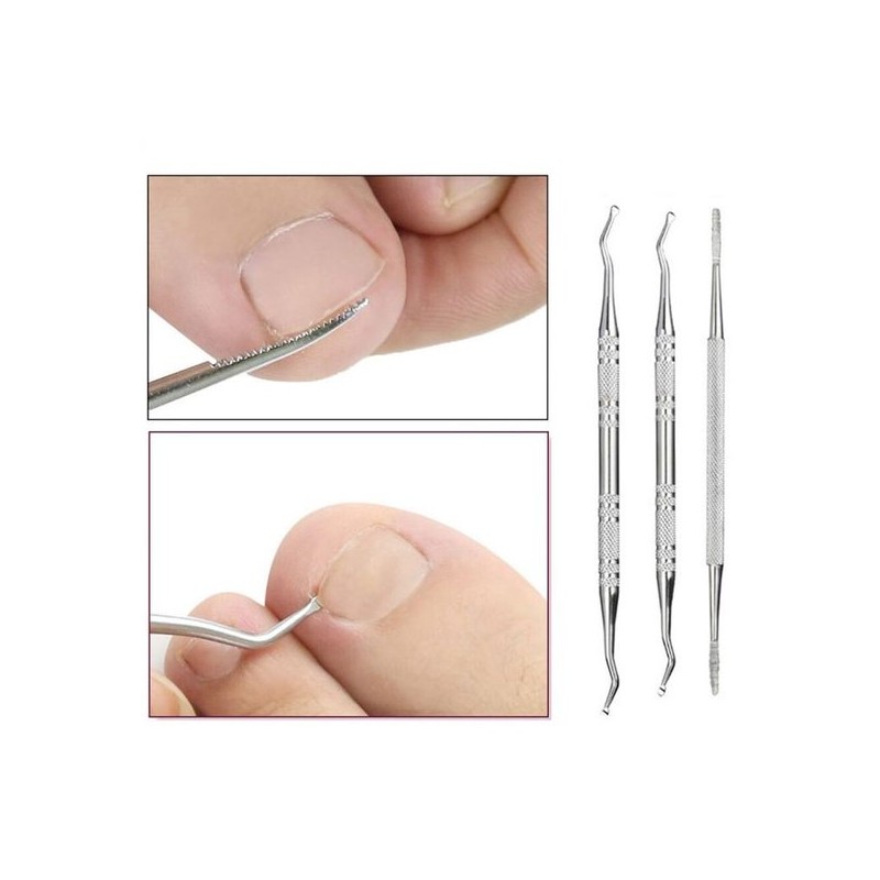 큐렛 3종세트 손톱 발톱 정리기 네일 Curette 3-Piece Set Nail