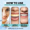 Ollie Teeth Whintening Strips, 28 PCs, 14 Treatments, Includes Shade