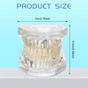 Outus Disease Teeth Model Dental Implant Teeth Model with Removable