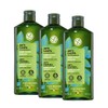 Yves Rocher | Set Shampoo Anticaspa | Sin Sulfatos |