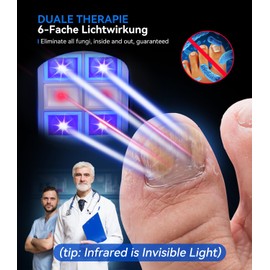 6.0 Top Upgrade Nagelpil Lasergerä【Upgrade 4*Blau & 2*Infrarotlicht - Verdoppeln Sie die】【mit Zeitanzeige - Nagelpilz Lasergerät Testsieger】Für Finger und Fußnägel 99% Pilzbefall