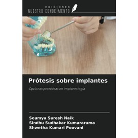 Prótesis sobre implantes: Opciones protésicas en implantología