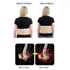 Benesta - Faja Lumbar Neopreno Rehabilitación Negro Unitalla Dr Meyer