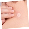 TOVINANNA 6sheets Breathable Hydrocolloid Spot Patches for Pimple Treatment Remover
