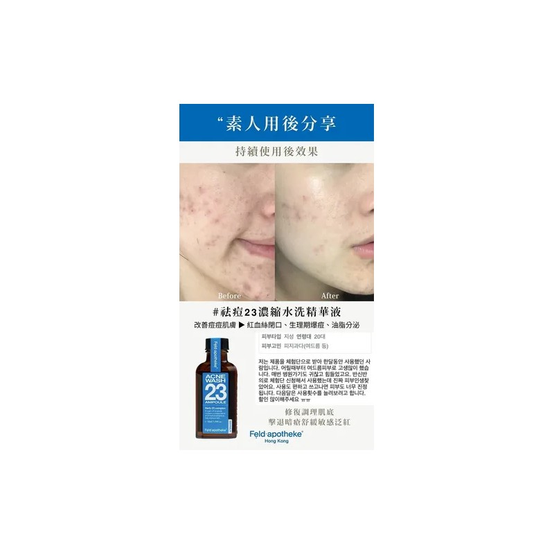 Ampolleta Acne Wash 23 Ampoule De Feld Apotheke De 53ml