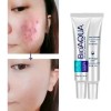 Bioaqua Acne Cream Reduce Cicatrices Poros Grasa Cuidado Continuo